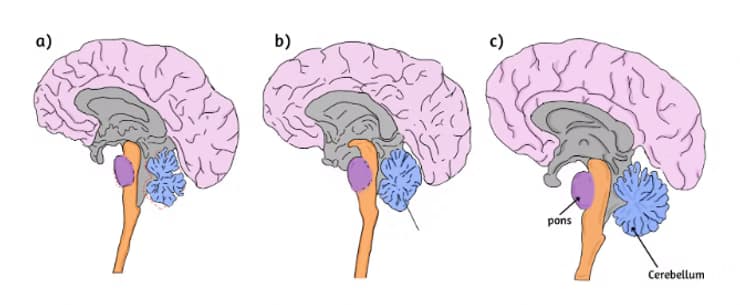 A Comprehensive Review and Evaluation of the Diagnostic Methods of a Multiple System Atrophy Diagnosis